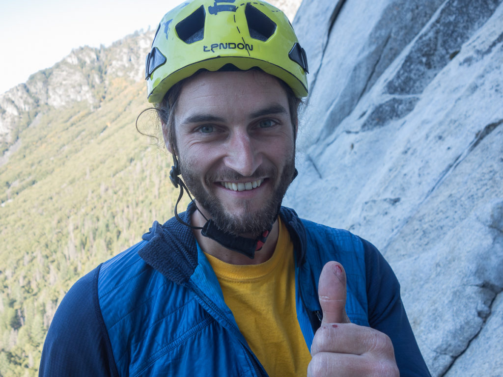 Heart Ledges, Pancakes machen sollte man können! Wie wird das im Boulderproblem mit zwei verbrannten Daumen?